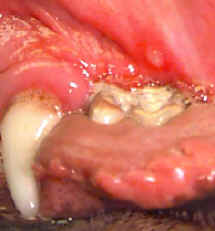 ulcer.jpg