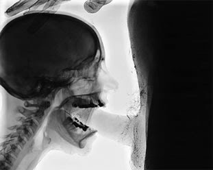 x-ray-blowjob.jpg