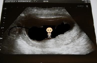 gumbobabyinsideview.jpg