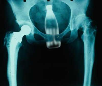 X-RAY.jpg