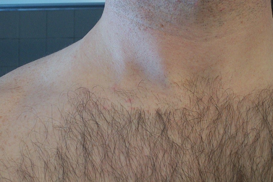chesthair02.jpg